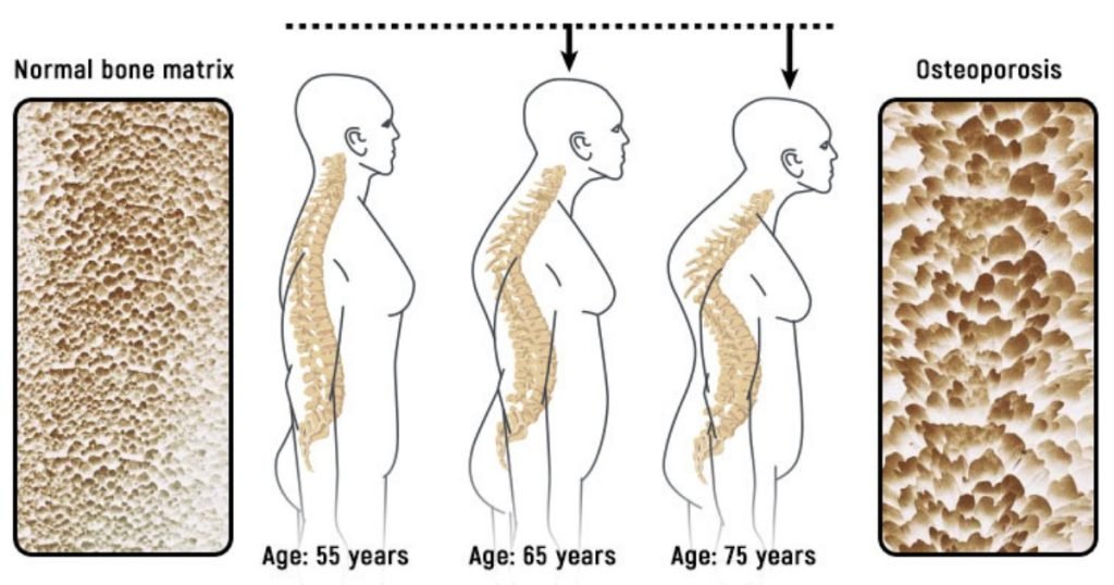 Experts Agree That Soda Is One Of The Most Harmful Beverages