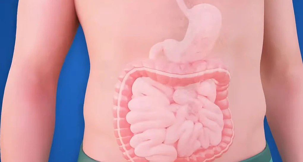 Acute vs Chronic Gastritis: Why One Heals and One Doesn't
