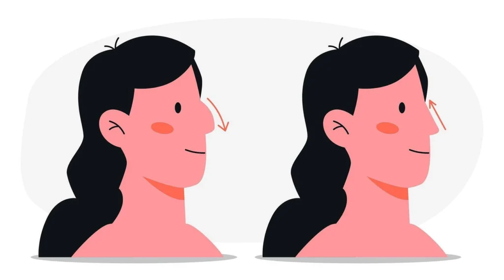 How Kybella Works to Eliminate Stubborn Chin Fat: A Guide