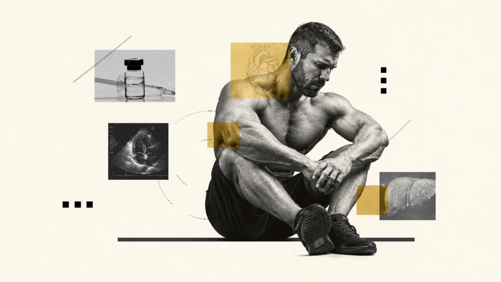 Are Steroids Bad for You? What Quitting Doesn't Undo